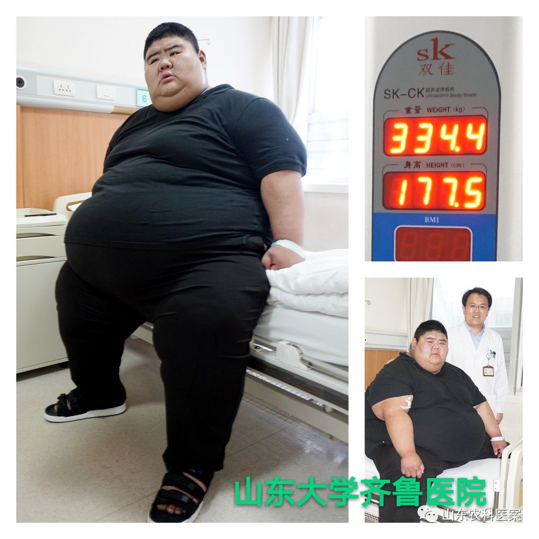 “山东第一胖”十个月减重363斤,他是如何做到的?