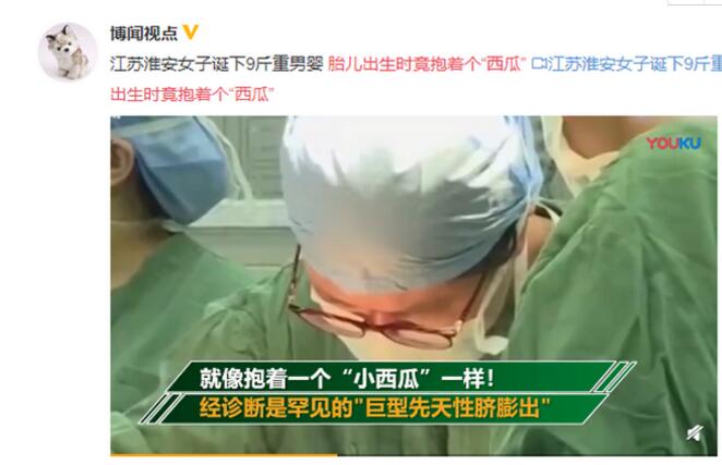 惊了！胎儿出生竟抱个西瓜!诊断为罕见病,只因妈妈没注意这一细节