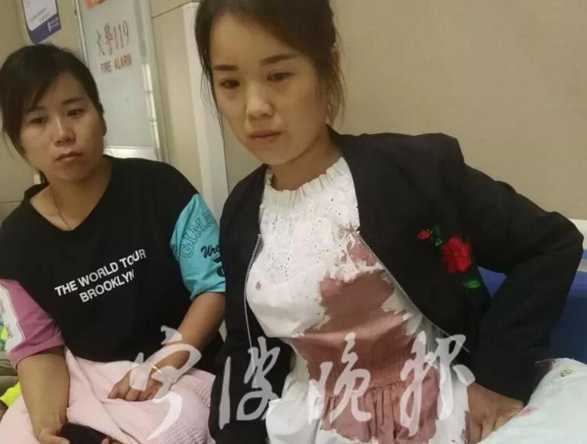 男孩遭宠物犬撕咬伤情严重 自家狗咬了人，狗主态度如何?