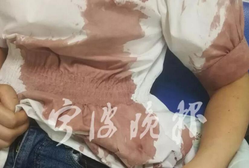 男孩遭宠物犬撕咬伤情严重 自家狗咬了人，狗主态度如何?