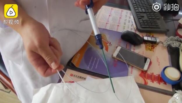 怎么做到的?女孩醉酒吞下汤勺 酒醉后含着15公分汤勺无意识吞下