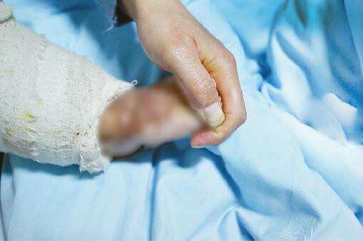 与痛同生！聊城双胞胎重度烧伤458天后，他们要战胜的不只是疼痛