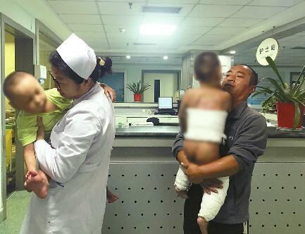 与痛同生！聊城双胞胎重度烧伤458天后，他们要战胜的不只是疼痛