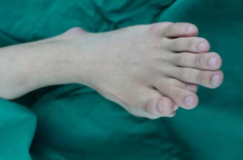 罕见至极一足生9趾!为什么会这样?真相实在太让人惊愕