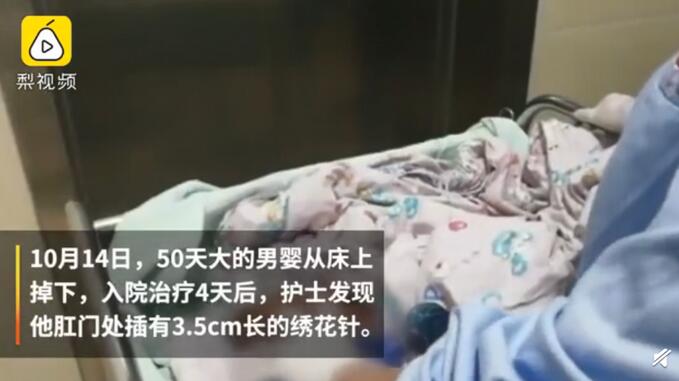 是谁下此毒手？出生仅50天的男婴肛门被插绣花针，接二连三受伤