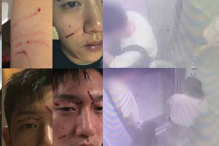 突发！29岁韩国歌手具荷拉家中死亡 曾因雪莉去世痛苦！ 