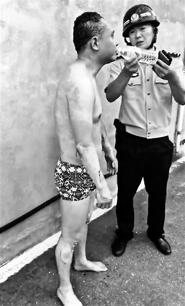 民警因突发事件致全身60%烧伤：冲进去我责无旁贷