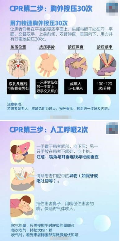 高以翔猝死去世!心脏骤停正确抢救 心脏骤停