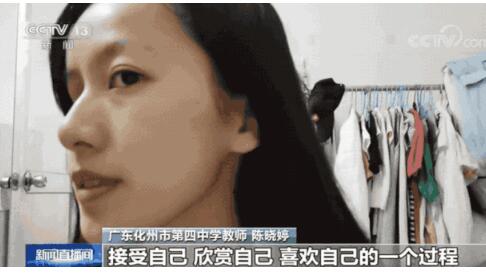 令人感动!90后单眼女教师活得精彩 最美的语言不够形容她