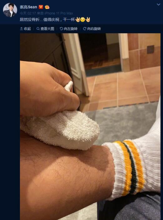 张亮怼恶评是怎么回事？为什么网友留言“活该”？