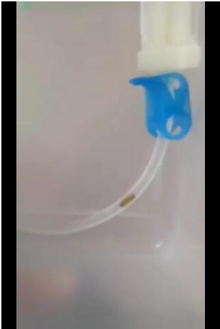 令人细思极恐!幼儿输液时疑有虫 医院向患儿家属致歉