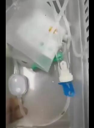 令人细思极恐!幼儿输液时疑有虫 医院向患儿家属致歉