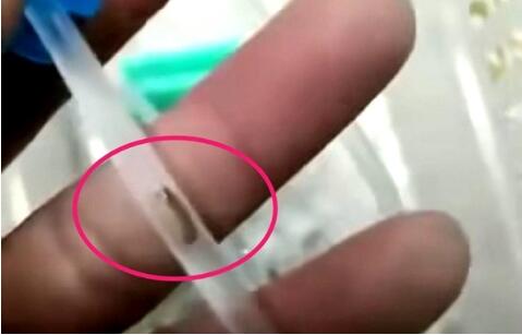 四川乐山:幼儿输液时疑有虫 输液管中有疑似小虫子的不明物体