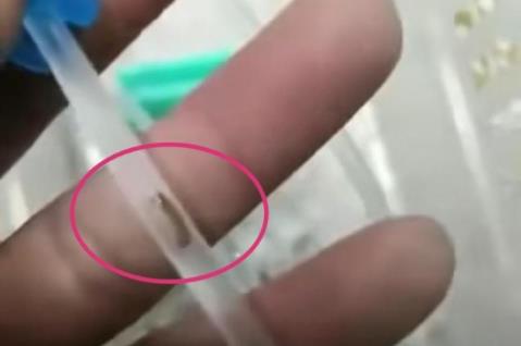 令人揪心!幼儿输液时疑有虫怎么回事?真相了原来是这样!