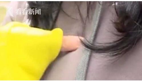 令人哭笑不得!花23万整出四个胸 全麻手术过程中突然清醒