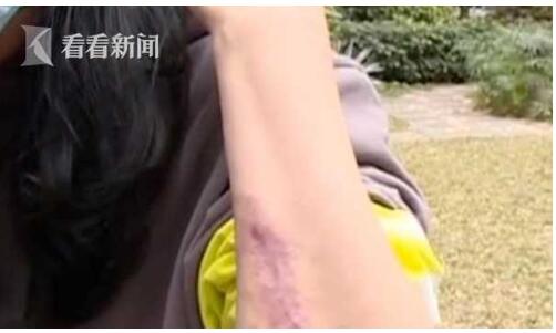 令人哭笑不得!花23万整出四个胸 全麻手术过程中突然清醒