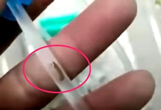 幼儿输液管发现疑似有虫 涉事医疗器械公司:正调查