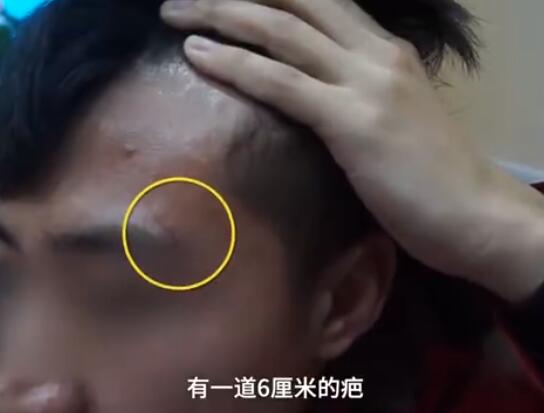 恐怖!因奖学金被捅伤是怎么回事?终于真相了,原来是这样!