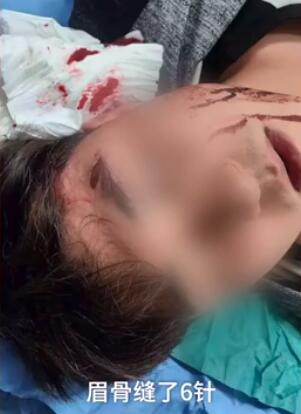 恐怖!因奖学金被捅伤是怎么回事?终于真相了,原来是这样!