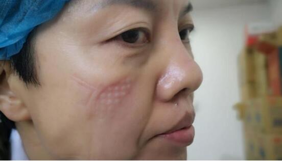 脱下军装也要继续战斗，上海退役女兵李晓静率50名“娘子军”驰援武汉