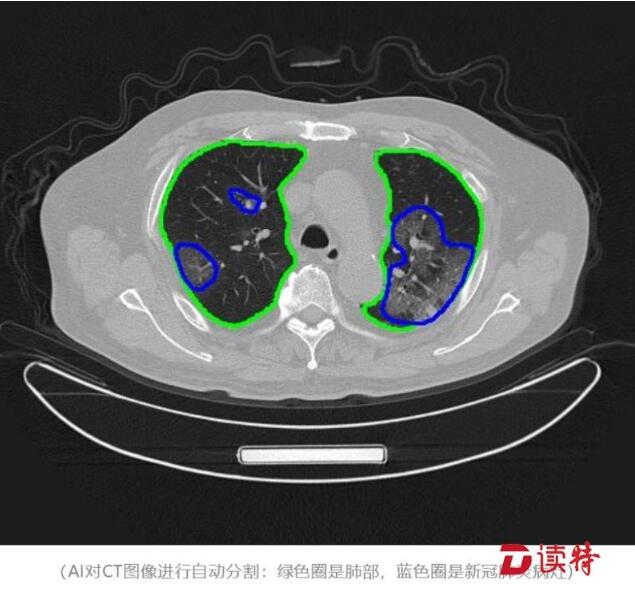深圳战疫情保发展中的企业尖兵