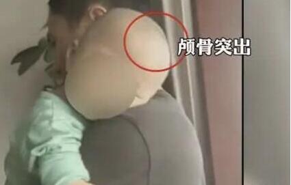 【最新进展】湖南郴州再现“大头娃娃” 终于真相了原来是这样!