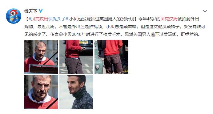 “万人迷”贝克汉姆快秃头了 岁月催人老，头发最明显了