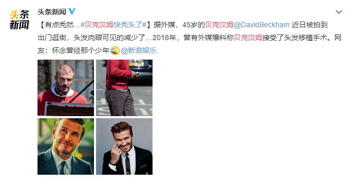 “万人迷”贝克汉姆快秃头了 岁月催人老，头发最明显了
