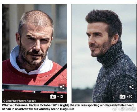 秃然来袭！时光对这位男神做了什么？贝克汉姆快秃头了