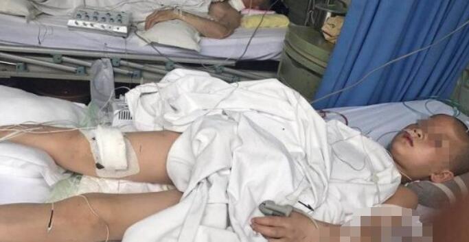 【最新】女童被继父连砍4刀确诊高位截瘫 事件始末全过程曝光