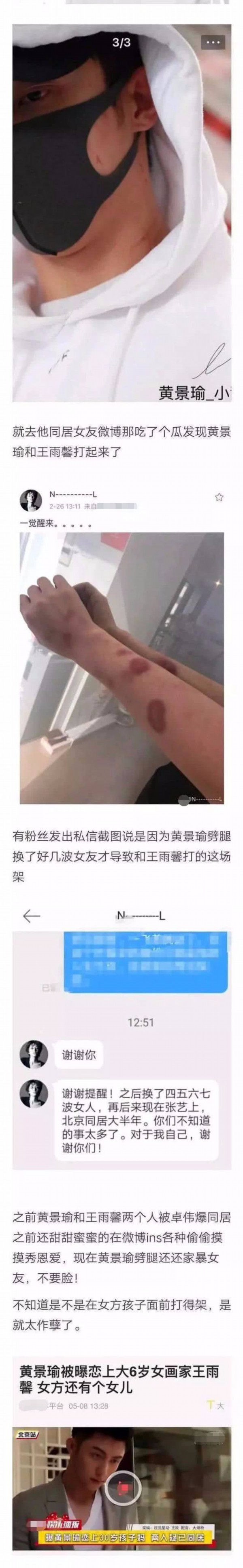 黄景瑜前女友自杀未遂是怎么回事?发文再见了曾深爱的大男孩什么情况?