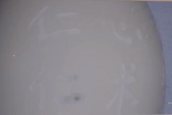 活久见！医生练就在生鸡蛋壳上刻字绝活是怎么回事?什么情况?