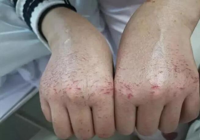 打开 “小姐姐的手还疼吗？”
