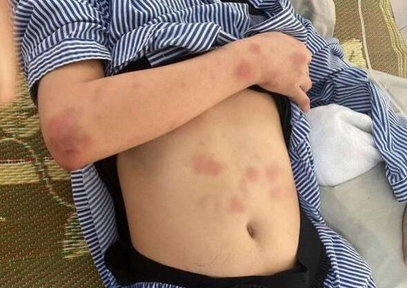 【最新】男子求爱失败暴打学妹2小时 男子求爱失败暴打学妹详情始末曝光