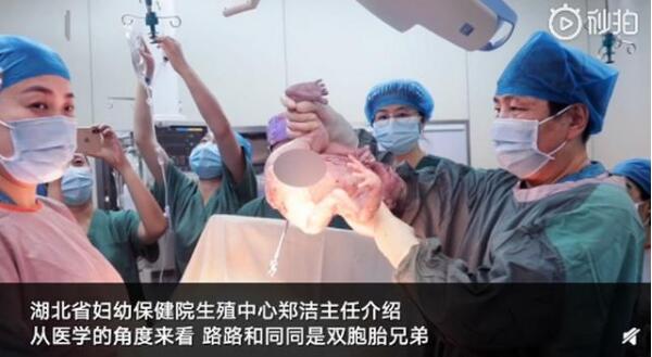 活久见！湖北一双胞胎兄弟相差10岁是怎么回事?什么情况?终于真相了,原来是这样!