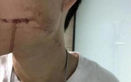小伙拔牙10天后脑出血死亡|小伙拔牙10天后脑出血死亡引热议 涉事医院回应了吗?详情始末