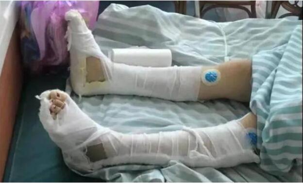 遭家暴跳楼致截瘫女子已离婚|事件后续来了：遭家暴跳楼致截瘫女子已离婚 用离婚“终结”家暴远远不够