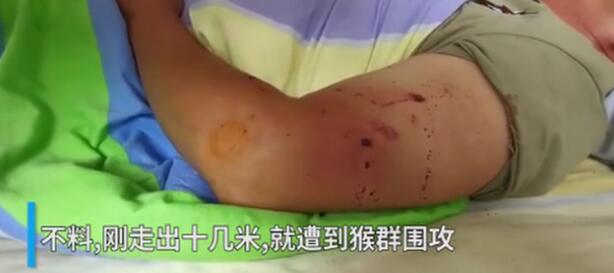 男子见义勇为被猴群报复什么情况?终于真相了,原来是这样!