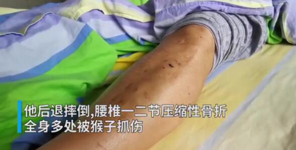 男子见义勇为被猴群报复什么情况?终于真相了,原来是这样!