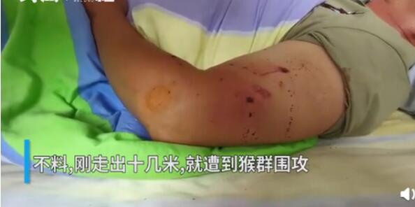 【哭笑不得】男子见义勇为被猴群报复 当时到底发生了什么事？