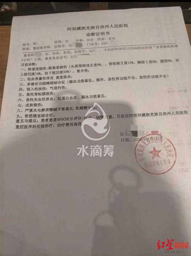 网红拉姆遭前夫纵火重度烧伤什么情况？终于真相了，原来是这样！