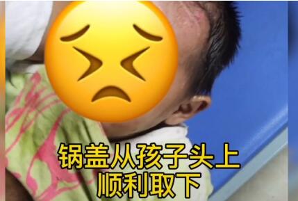 男孩脑袋卡进锅盖取不下来 网友：心疼孩子，但忍不住笑了！