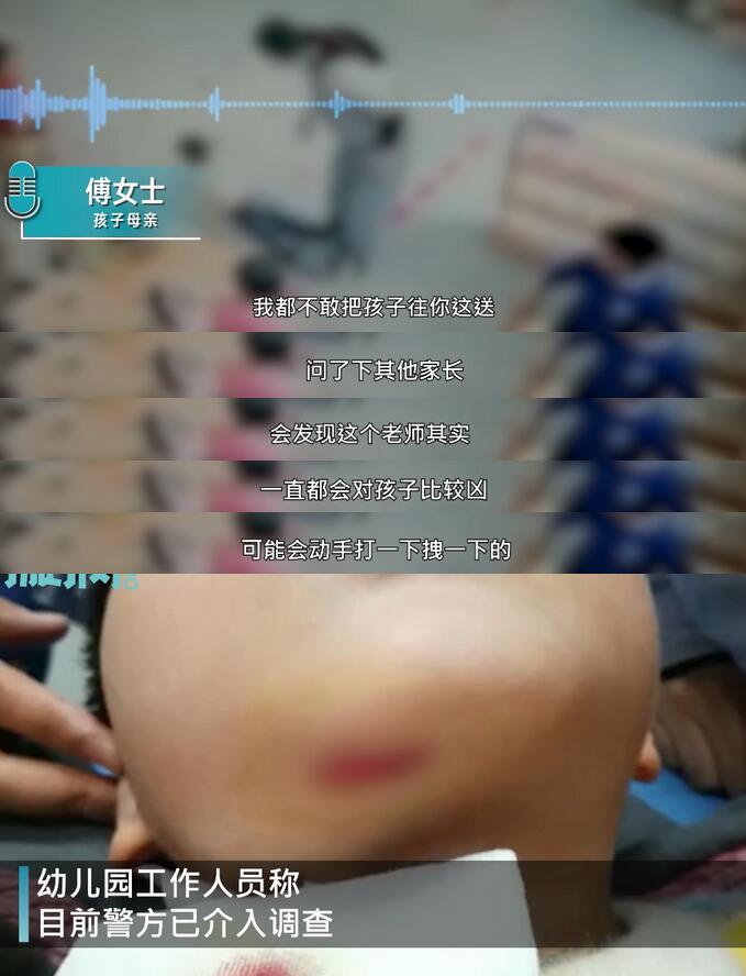 【后续来了】被幼师扔摔缝8针男童母亲发声，监控拍下虐心一幕