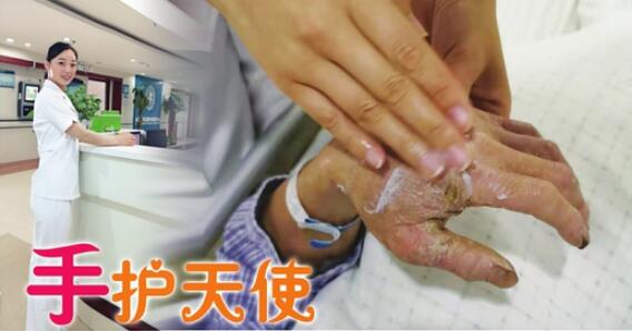 这是一双“最美丽的手” 济南护士给受伤的农民工涂护手霜走红网络