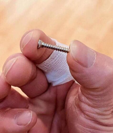 陶喆取出放在手指里15年的螺丝 具体发生了什么？