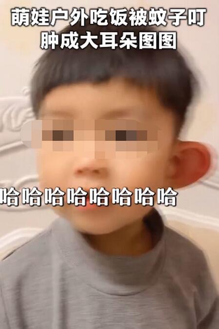 心疼又好笑!男孩被蚊子叮成大耳朵图图,肿得都发亮了