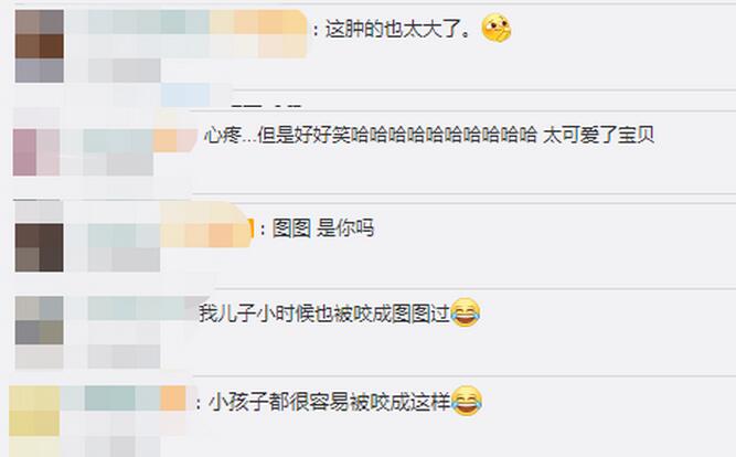 心疼又好笑!男孩被蚊子叮成大耳朵图图,肿得都发亮了