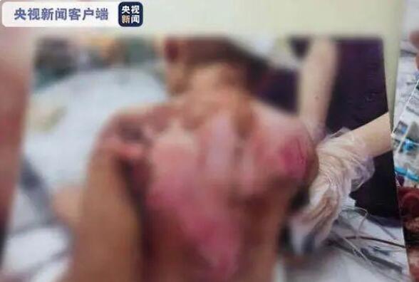 最新!❗️❗️女童被虐案宣判 生母获刑3年 案件详情回顾
