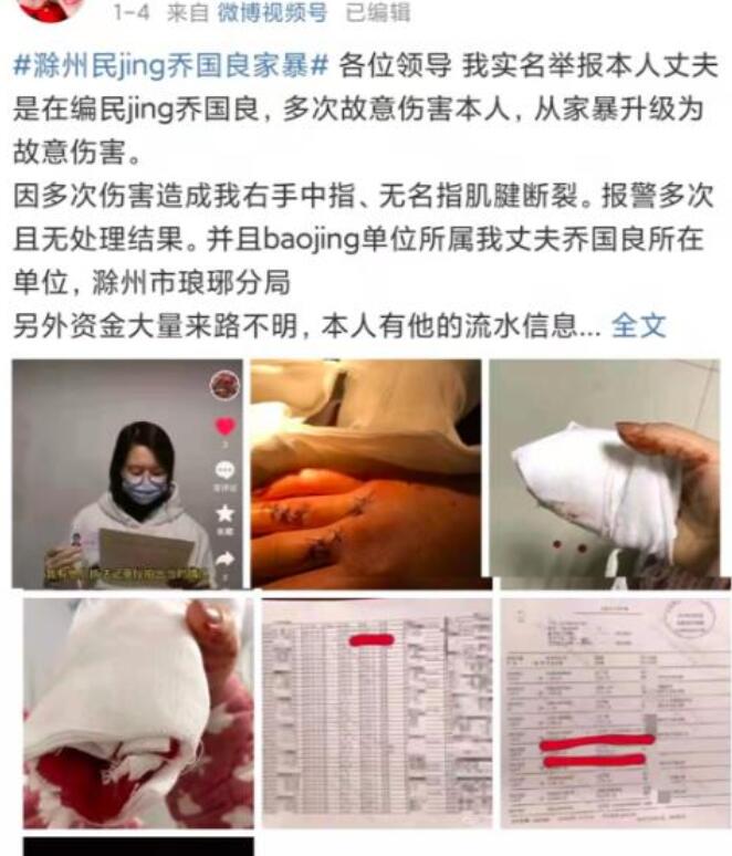 可恶！女子举报民警丈夫家暴 男方被停职 伤痕累累怎么解释？