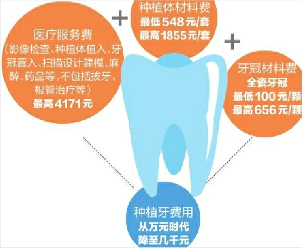 种植牙降价在山东落地 种一颗牙便宜好几千元